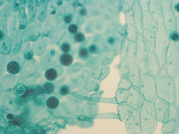 Fern Gametophyte Slides - Ferngametophyte 02 200X